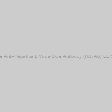 Image of Mouse Anti-Hepatitis B Virus Core Antibody (HBcAb) ELISA Kit